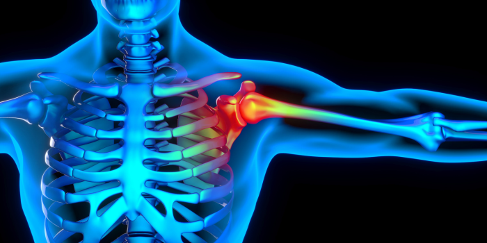 shoulder pain treatment. man xray pain in thompson north dakota. ricky morgan of MORGAiN phsyical therapy